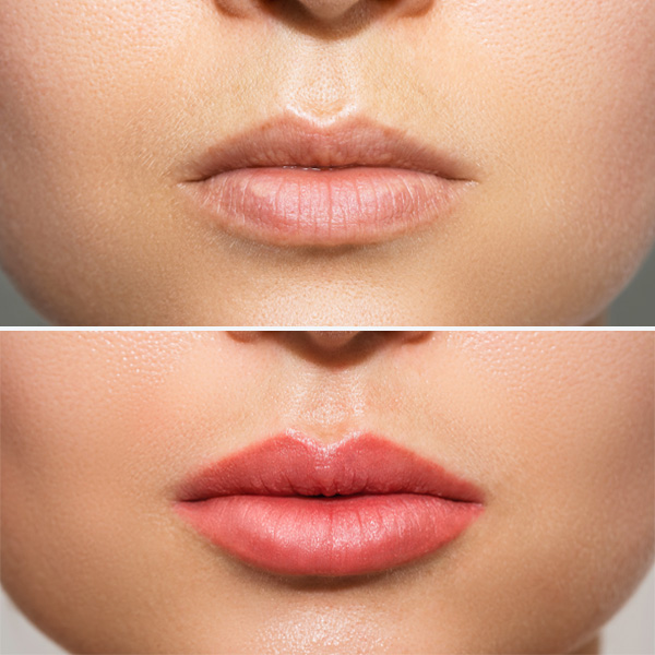 Maquillage permanent lèvres lille naturel